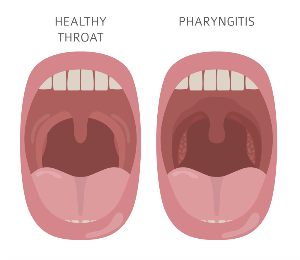 color picture of a healthy throat