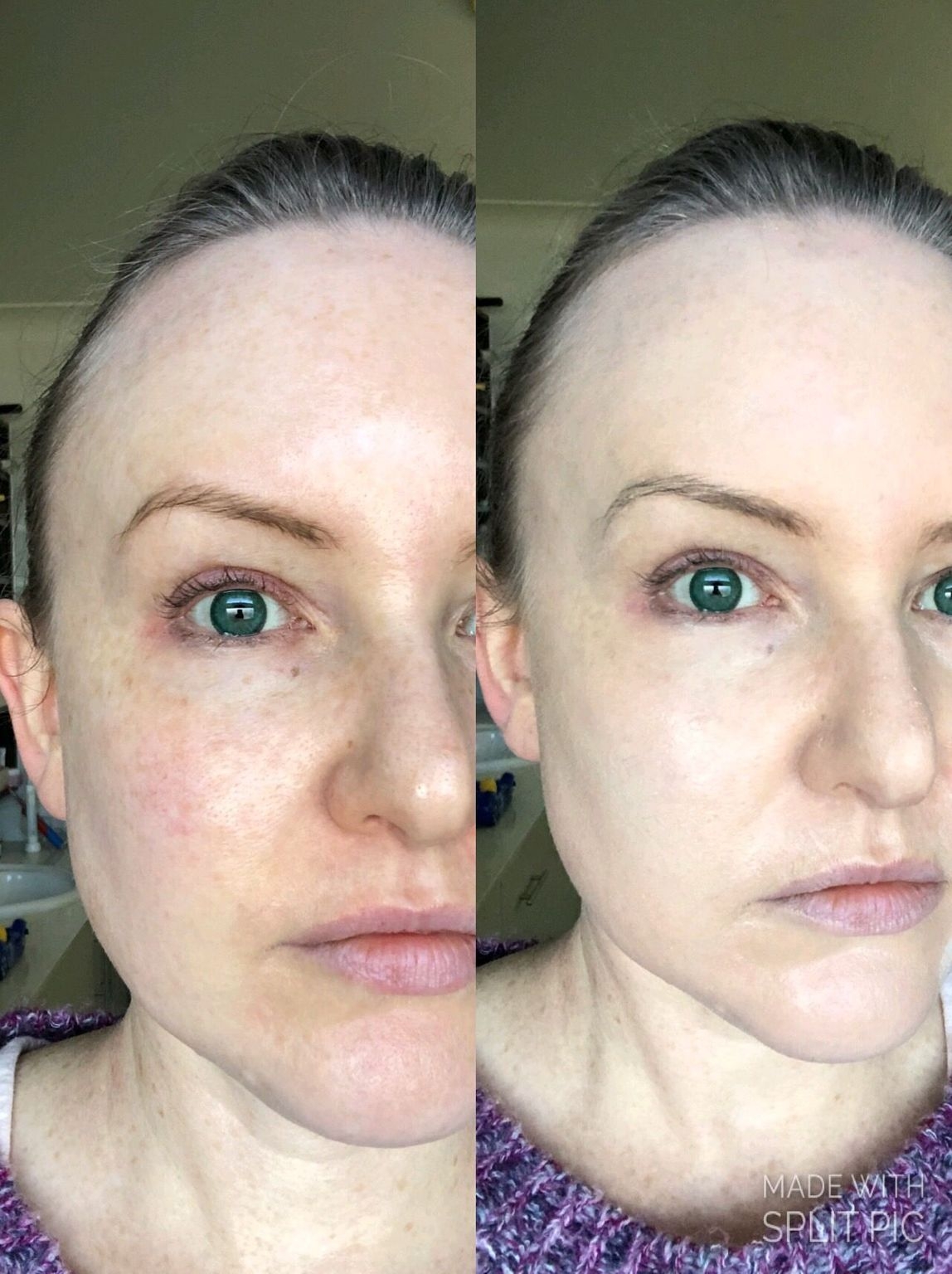 cicapair tiger grass color correcting treatment review